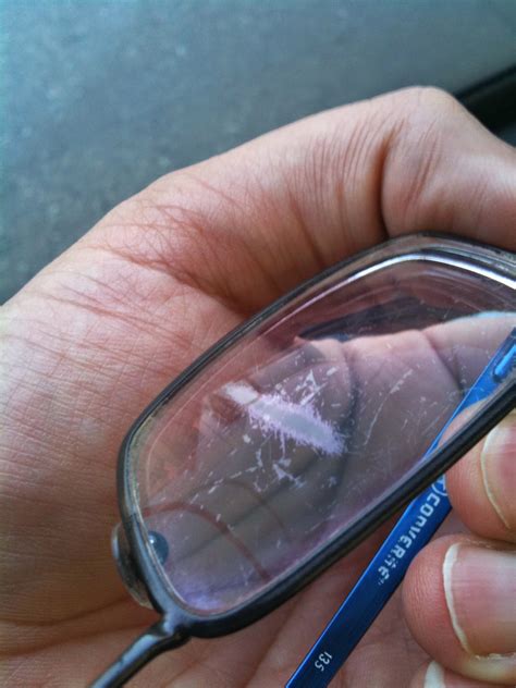 glasses lenses peeling.